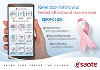 Download Breast Ultrasound Leaflet